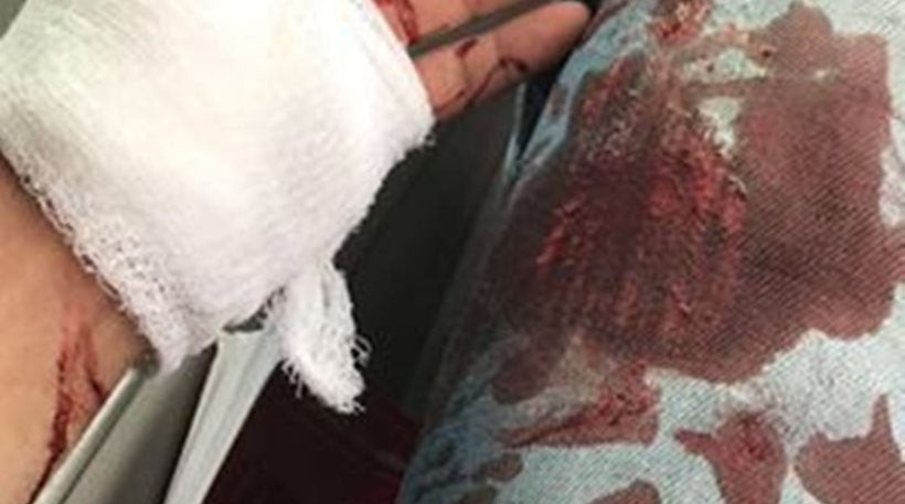 Έκρυθμη η κατάσταση στην Αμερική: Μαχαίρωσαν άντρα γιατί τον πέρασαν για νεοναζί (Eικόνες)